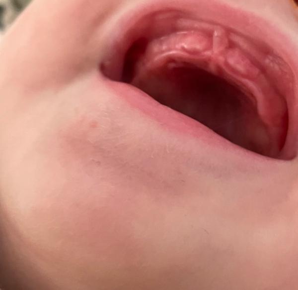 Bild zu Kommen die Schneidezähne ?? - Baby Forum - Allgemeine Themen