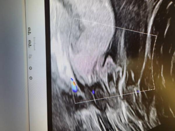 Bild zu Mädchen oder Junge - Baby Forum - Allgemeine Themen
