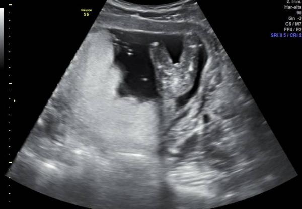 Bild zu Mädchen oder Junge, was meint ihr? - Baby Forum - Allgemeine Themen