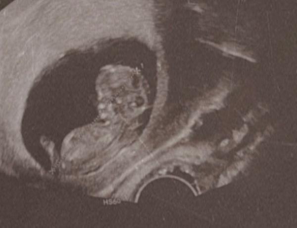 Bild zu Geschlecht raten durch Erfahrungenđ - Baby Forum - Allgemeine Themen