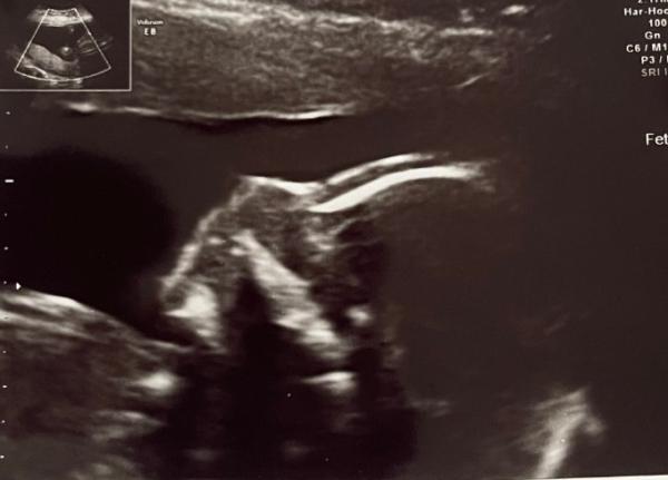 Bild zu Hilfe bitte - Baby Forum - Allgemeine Themen