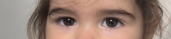 Bild zu Schlupflider - Baby Forum - Allgemeine Themen