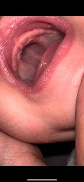 Bild zu sieht das für euch normal aus? - Baby Forum - Allgemeine Themen