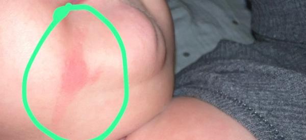 Bild zu Was kann das sein? - Baby Forum - Allgemeine Themen