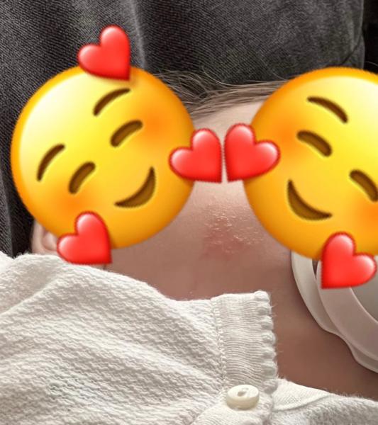 Bild zu könnt ihr mir sagen was das sein kann? - Baby Forum - Allgemeine Themen