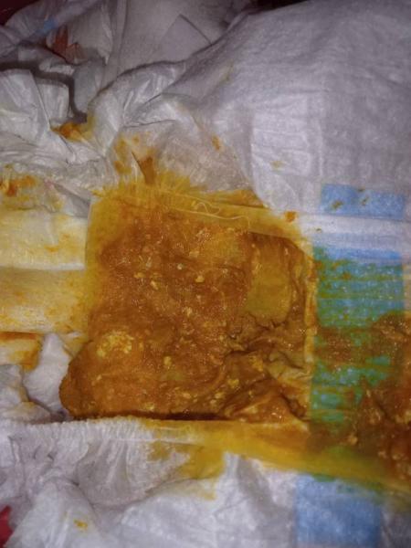 Bild zu Farbe des Stuhlgangs. - Baby Forum - Allgemeine Themen
