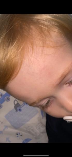 Bild zu Wieder ausschlag ?? - Baby Forum - Allgemeine Themen