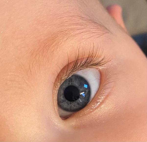 Bild zu Augenfarbe - Baby Forum - Allgemeine Themen