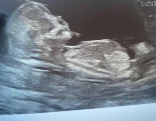 Bild zu Junge oder Mädchen? - Baby Forum - Allgemeine Themen