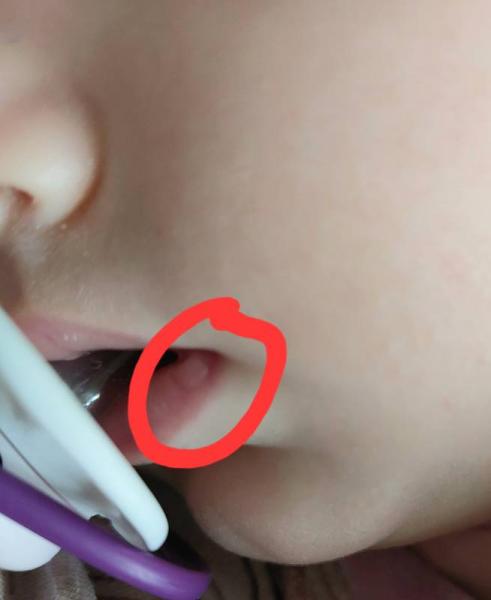 Bild zu Stillblase? - Baby Forum - Allgemeine Themen