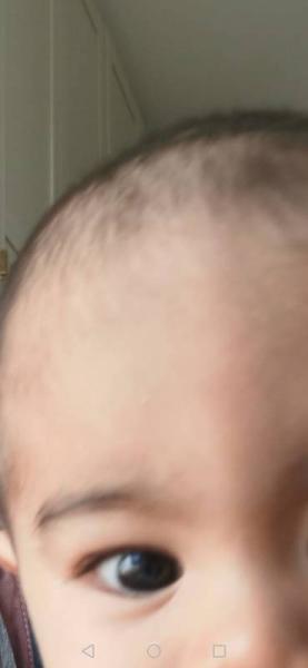 Bild zu Baby 11 monate geschwollenes auge/augenringe? - Baby Forum - Allgemeine Themen