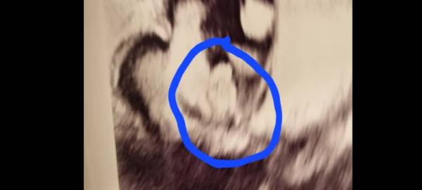 Bild zu Mädchen oder Junge? - Baby Forum - Allgemeine Themen