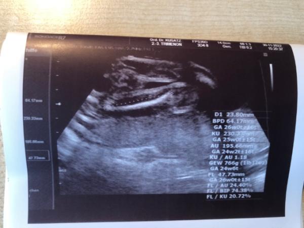 Bild zu Mädchen oder Junge?? - Baby Forum - Allgemeine Themen