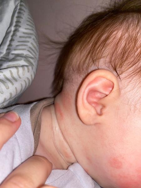 Bild zu Was ist das? - Baby Forum - Allgemeine Themen