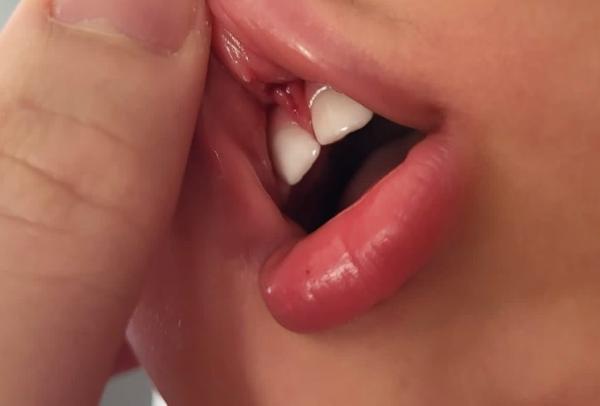 Bild zu Kind (15) Monate auf Mund gefallen! - Baby Forum - Allgemeine Themen