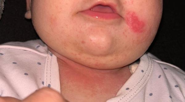 Bild zu Was ist das ?? - Baby Forum - Allgemeine Themen