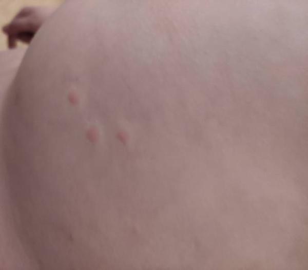 Bild zu Ausschlag - Baby Forum - Allgemeine Themen