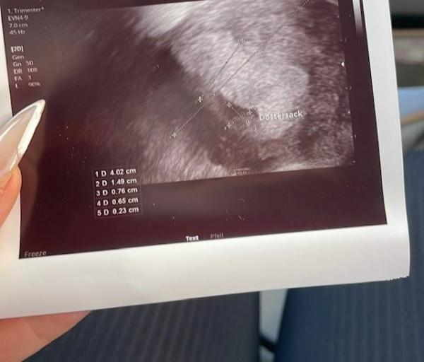 Bild zu Verwirrung - Baby Forum - Allgemeine Themen