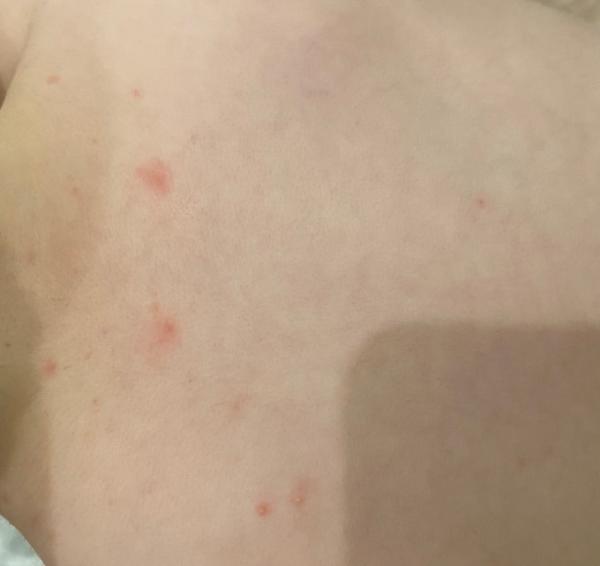 Bild zu Was kann das sein? - Baby Forum - Allgemeine Themen