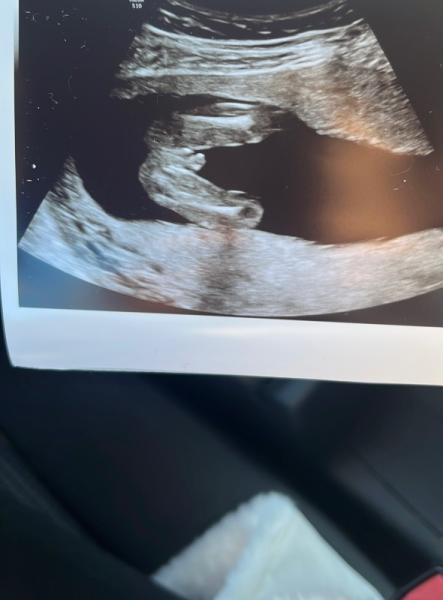 Bild zu Geschlechtsouting? - Baby Forum - Allgemeine Themen