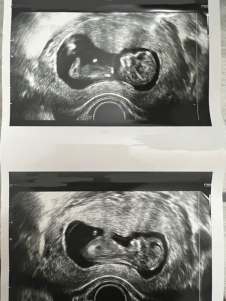 Bild zu Nub Theorie - Baby Forum - Allgemeine Themen