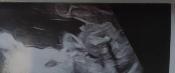 Bild zu Wisst ihr das Geschlecht? - Baby Forum - Allgemeine Themen