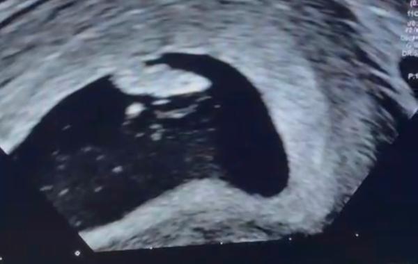 Bild zu Ramzi Methode - Baby Forum - Allgemeine Themen
