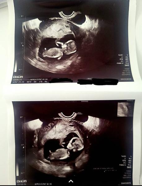 Bild zu 12 +1 Geschlecht? - Baby Forum - Allgemeine Themen