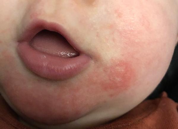 Bild zu Hilfe, ist das normal? - Baby Forum - Allgemeine Themen