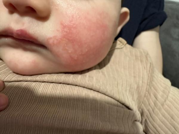Bild zu Hilfe was kann ich noch tun ? - Baby Forum - Allgemeine Themen