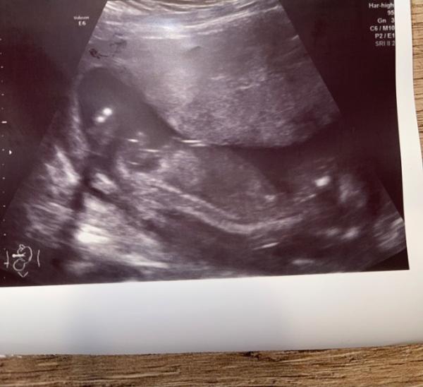 Bild zu Hallo liebe Mamis - Baby Forum - Allgemeine Themen