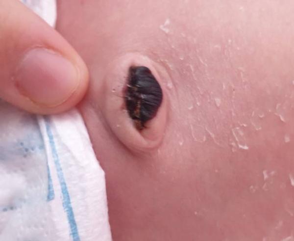Bild zu Weiß jemand was das ist? :o - Baby Forum - Allgemeine Themen