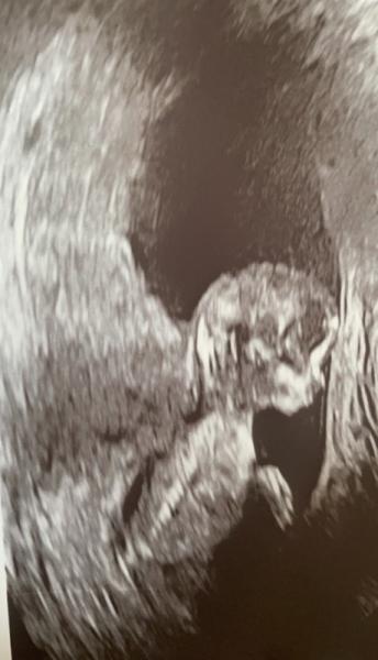 Bild zu Was wird es? - Baby Forum - Allgemeine Themen