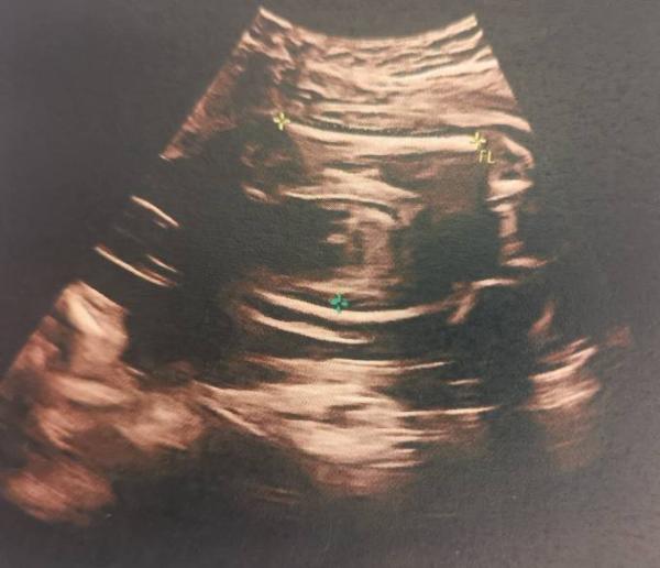 Bild zu Mädchen oder Junge? - Baby Forum - Allgemeine Themen