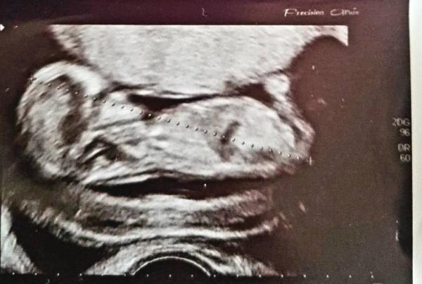Bild zu Geschlecht - Baby Forum - Allgemeine Themen