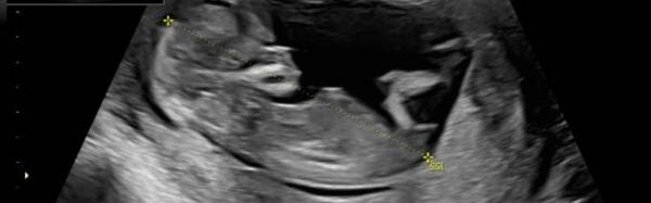 Bild zu Junge oder Mädchen? - Baby Forum - Allgemeine Themen
