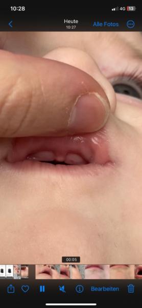 Bild zu Zahn? - Baby Forum - Allgemeine Themen