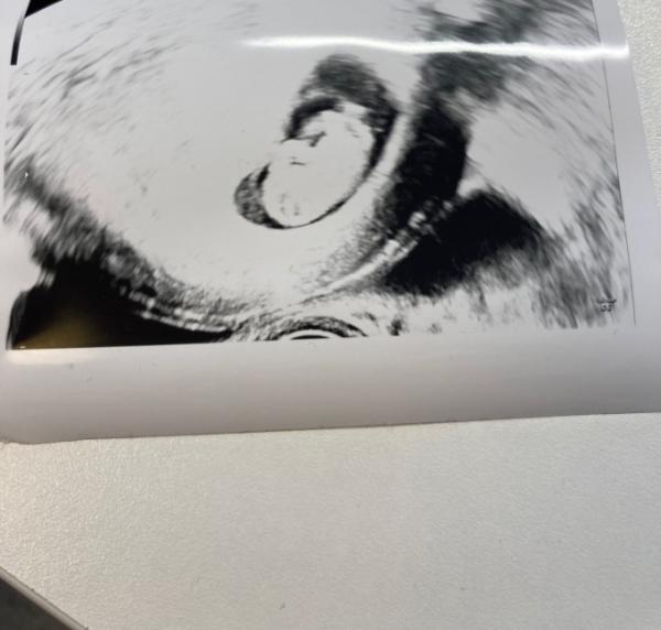 Bild zu Ramzi Methode - Baby Forum - Allgemeine Themen