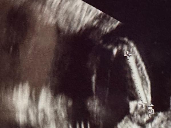 Bild zu Junge oder Mädchen - Baby Forum - Allgemeine Themen