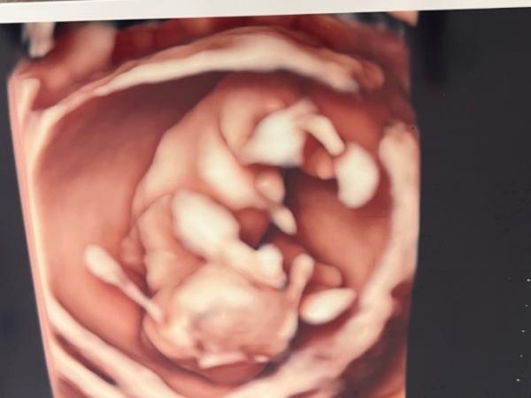 Bild zu Junge oder Mädchen - Baby Forum - Allgemeine Themen