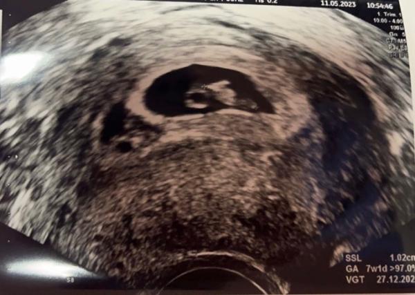 Bild zu Junge oder Mädchen? - Baby Forum - Allgemeine Themen