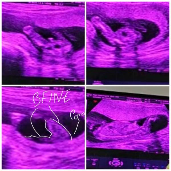 Bild zu Junge oder Mädchen? - Baby Forum - Allgemeine Themen