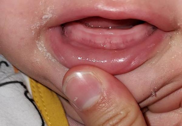 Bild zu Zahnt sie ? - Baby Forum - Allgemeine Themen