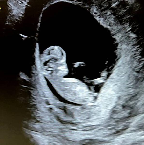 Bild zu Nub Theorie - Baby Forum - Allgemeine Themen
