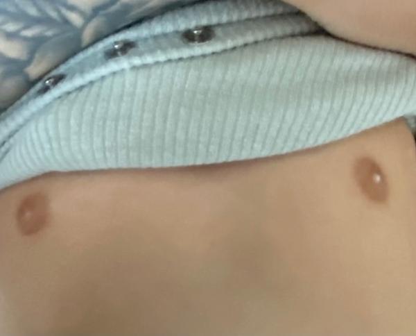 Bild zu Zum Arzt oder warten bis zur u6? - Baby Forum - Allgemeine Themen