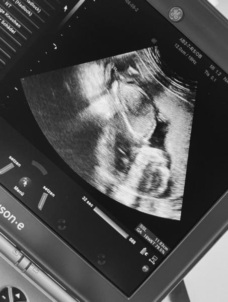 Bild zu Erst Junge dann doch Mädchen? - Baby Forum - Allgemeine Themen