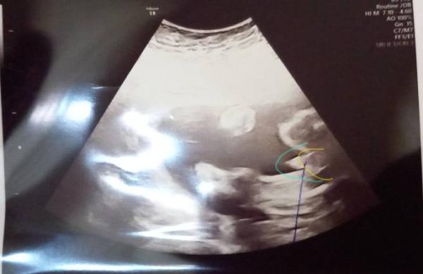 Bild zu Erst mädchen jetzt doch Junge - Baby Forum - Allgemeine Themen