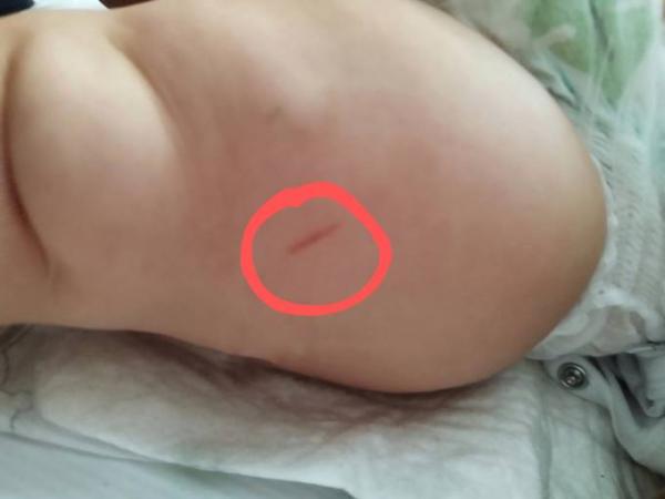 Bild zu Impfung 10 Monate - Baby Forum - Allgemeine Themen