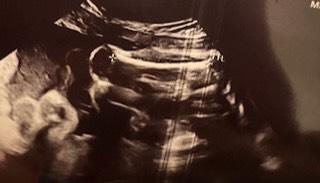 Bild zu 27.ssw - Baby Forum - Allgemeine Themen