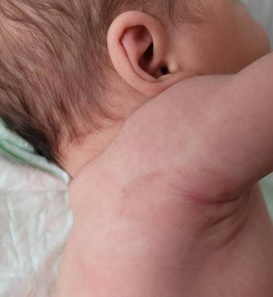 Bild zu Weiß jemand was das ist? Muttermal? Pigmentfleck? - Baby Forum - Allgemeine Themen
